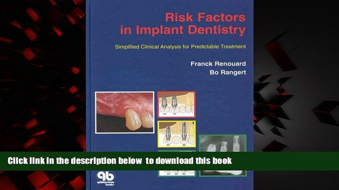 liberty books  Risk Factors in Implant Dentistry: Simplified Clinical Analysis for Predictable