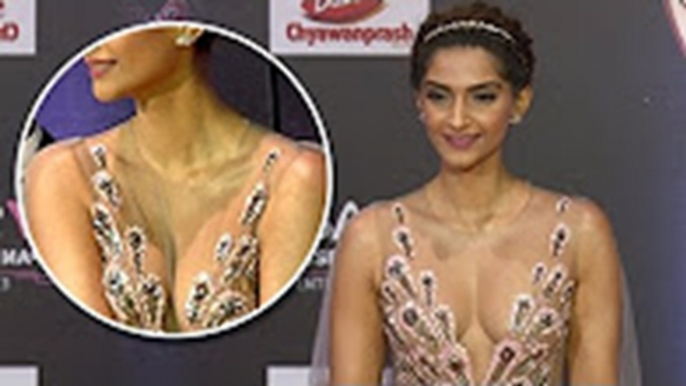 Sonam Kapoor In Transparent Dress | Stardust Awards 2016