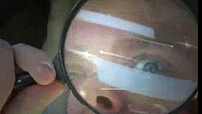 Burning people with magnifying glass