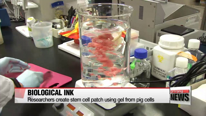 Korean researchers develop 3D-printed stem cell patch for heart patients