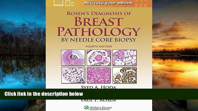 PDF  Rosen s Diagnosis of Breast Pathology by Needle Core Biopsy Syed A. Hoda MD  [DOWNLOAD] ONLINE