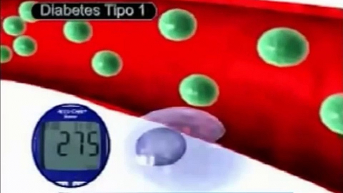 Que es la diabetes mellitus - Diferencias entre la diabetes tipo 1 y diabetes tipo 2