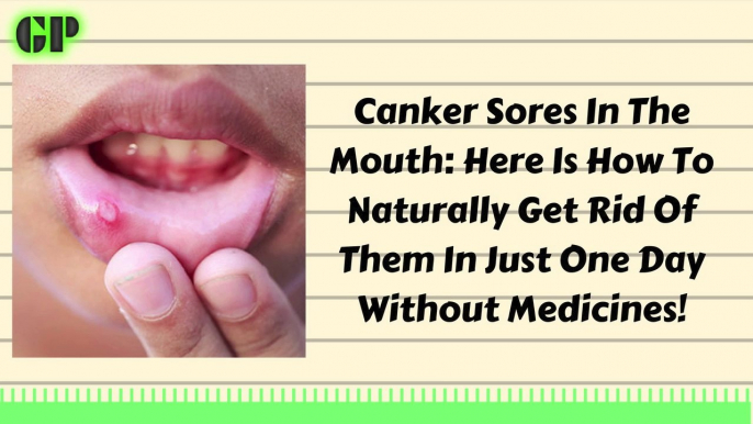 CANKER SORES IN THE MOUTH: Here Is How To Naturally Get Rid Of Them In Just One Day Without Medicine