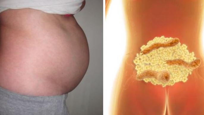 This is why you have bloated stomach and how to get rid of bloating and lose weight overnight