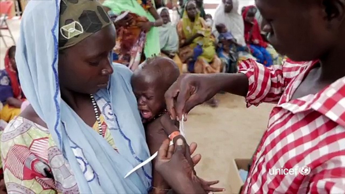 UNICEF Ambassador Stephen Rea in moving appeal for famine children