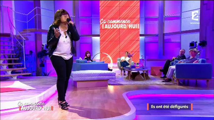 Défigurée, une témoin de Faustine Bollaert chante une chanson d'Adèle et émeut les téléspectateurs - Regardez