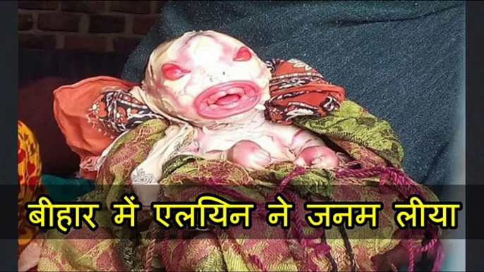 एलियन बच्चे ने बिहार में जन्म लिया उसके बाद माँ ने डरके मरे ऐसा कदम उठाया