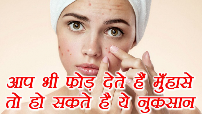 Pimples Popping is Very HARMFUL, आप भी फोड़ते हैं मुँहासे तो हो सकते है ये नुकसान | Boldsky