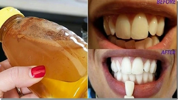 Los dentistas no quieren que salga a la luz! El método más rápido y seguro para blanquear dientes!