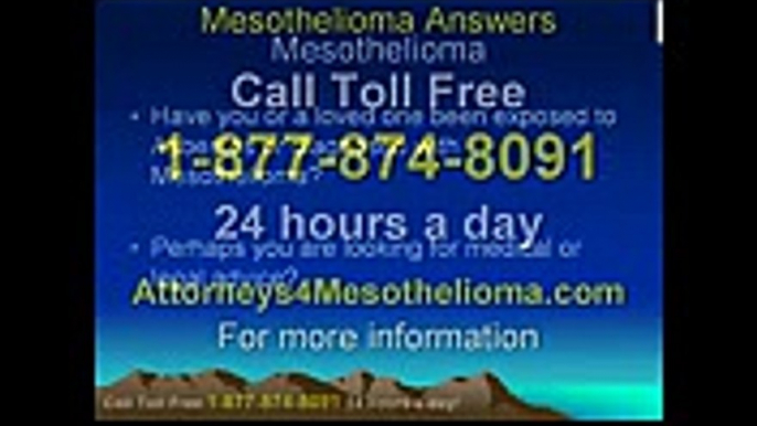 Mesothelioma Lawyers Call Toll Free 1-877-874-8091 Asbestos Attorney