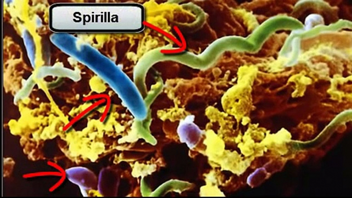 Eukaryotic Cells Vs. Prokaryotic Cells and Beria