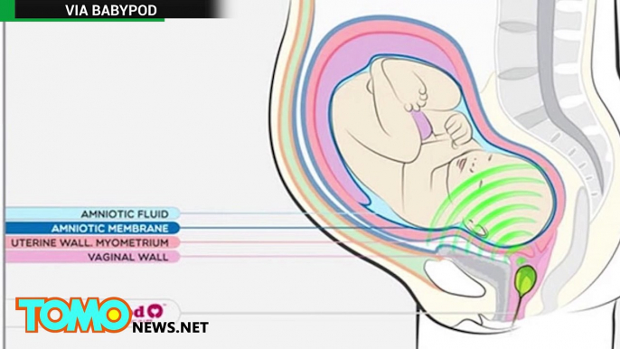 Clínica de Barcelona desarrolla parlante intrauterino para que un feto pueda escuchar musica