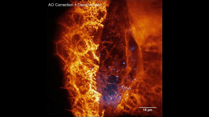 Premières images d'une cellule se déplaçant dans le corps