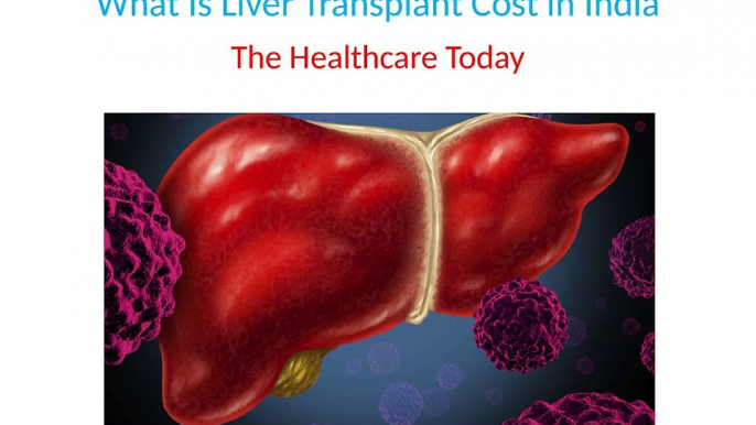 What Is Liver Transplant Cost in India