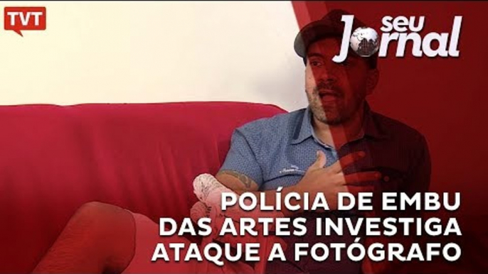 Polícia de Embu das Artes investiga ataque a fotógrafo