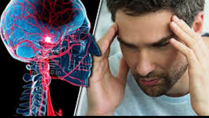 Stroke- symptoms and causes