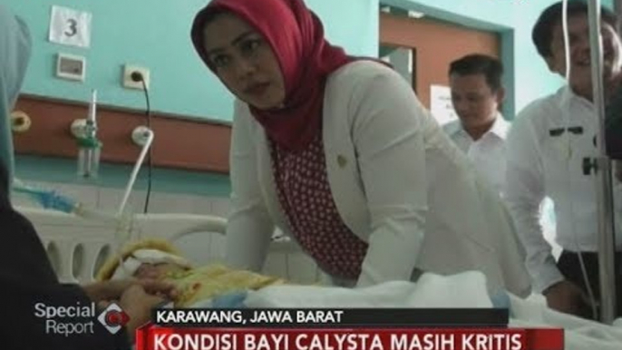 Bupati Karawang Jenguk Bayi Calista yang Dianiaya Hingga Infeksi Kornea - Special Report 21/03