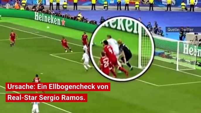 Eine Gehirnerschütterung bei Loris Karius hat wohl zu Patzern gegen Real beigetragen...