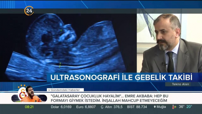 Ultrasonografi ile gebelik takibi