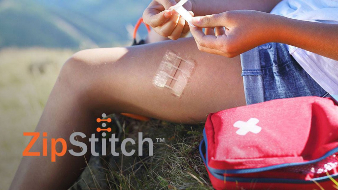 ZipStitch, la solución para cerrar heridas en cuestión de segundos