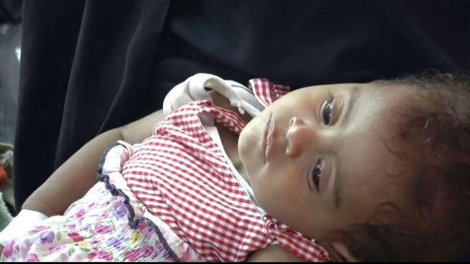 More Yemeni children die as medicine prices skyrocket