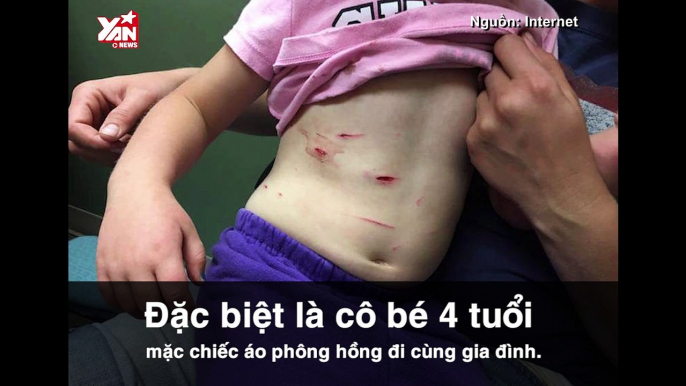 Cả rạp xiếc hốt hoàng, thất kinh khi bé gái 4 tuổi bất ngờ bị sư tử tấn công