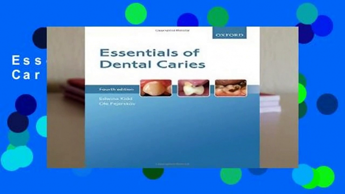 Essentials of Dental Caries