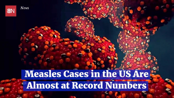 The Measles Are Becoming A Rapidly Growing Health Scare