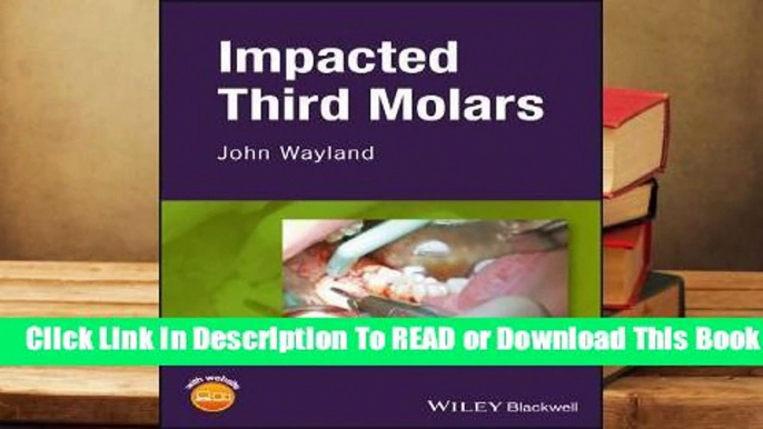 Online Impacted Third Molars  For Trial