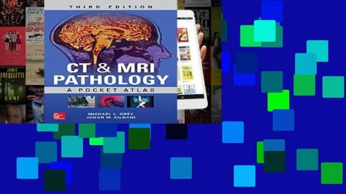 [READ] CT   MRI Pathology: A Pocket Atlas, Third Edition