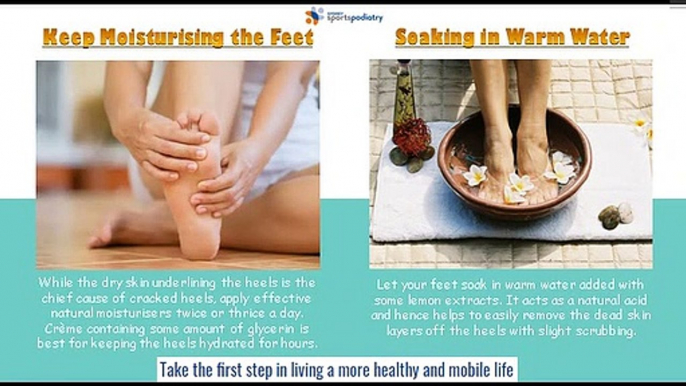 Cracked Heels Treatments for Easy & Quick Healing