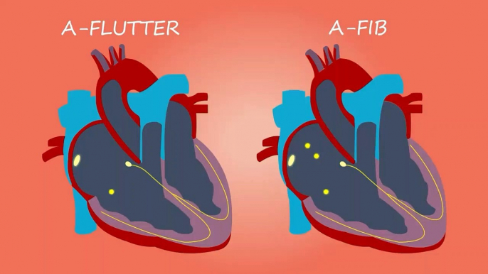 The Heart and Circulatory System - How They Work | Anatomy of the Heart | About Your Heart Attack | Nucleus Health //Anatomy and Function of the Heart