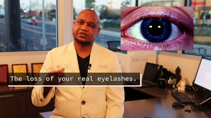 Are Fake Eyelashes Bad For You? Dr. U Discusses Pros & Cons