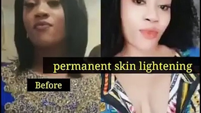 SKIN LIGHTENING CREAM IN Carletonville +27731769304Skin lightening in Rustenburg Skin lightening in Northern Cape Skin lightening in Kimberley Skin lightening in Kuruman Skin lightening in Port Nolloth Skin lightening in Western Cape Skin lightening in Be