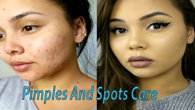 Pimples And Spots Care