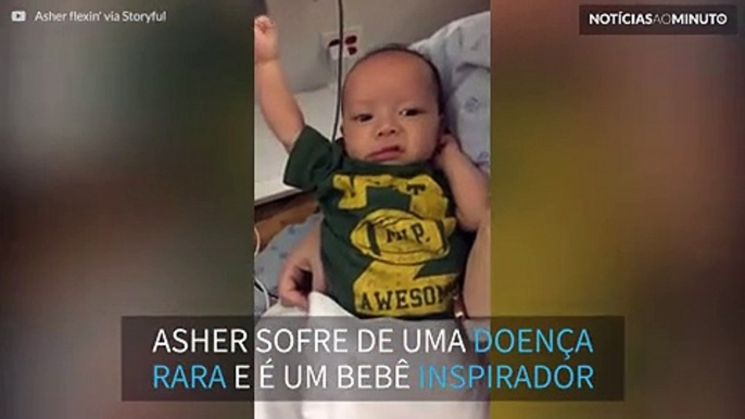 Após 3 cirurgias, bebê com doença rara mostra muque para mãe