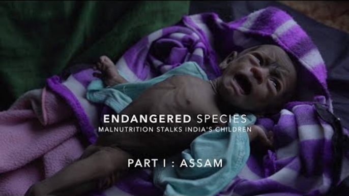 Why Are Most of India's Malnourished Children in Assam? | The Wire