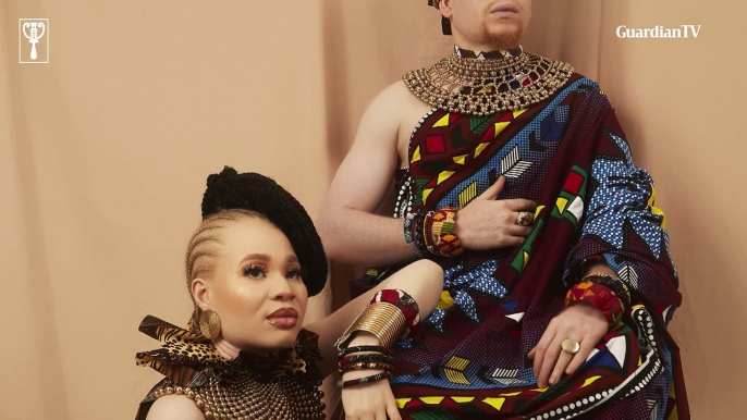 Strength beyond all odds: Living with albinism in Nigeria