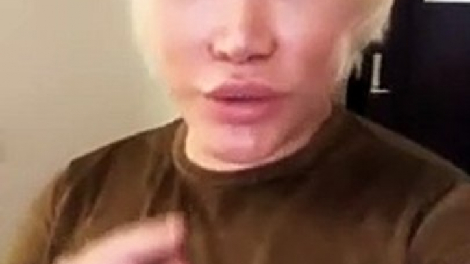 Rodrigo Alves, o "Ken Humano", mostra resultados da sua 63ª cirurgia