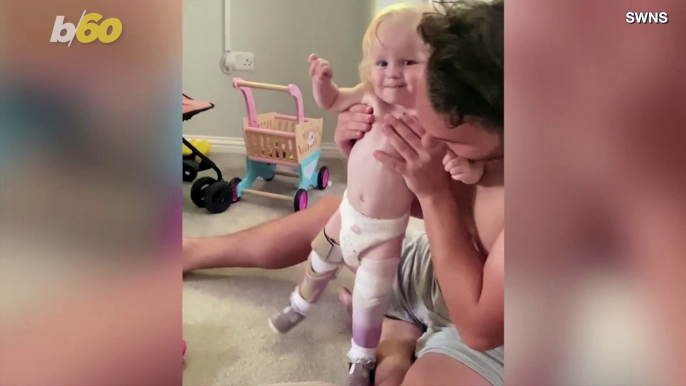 This Brave Little Girl Takes Her First Steps Thanks to Prosthetic Legs