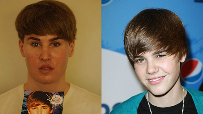 Justin Bieber : un homme dépense 70 000 euros en chirurgie pour lui ressembler