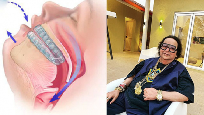 Bappi Lahiri को था Obstructive Sleep Apnea से हुआ | Symptoms जानना आपके लिए भी जरूरी |Boldsky