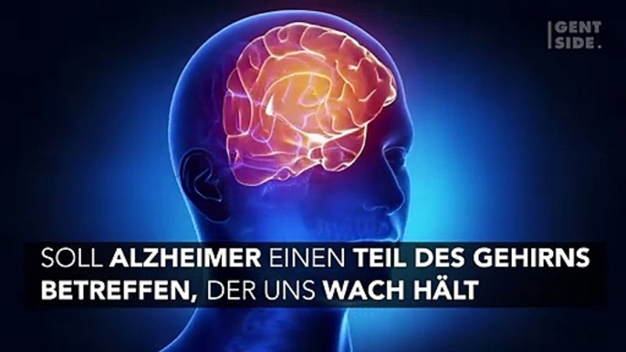 Alzheimer: Häufige Nickerchen können ein frühes Anzeichen der Krankheit sein