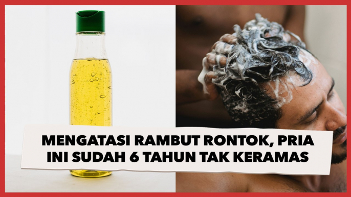 Diklaim Bisa Membantu Mengatasi Rambut Rontok, Pria Ini Sudah 6 Tahun Pilih Tidak Keramas