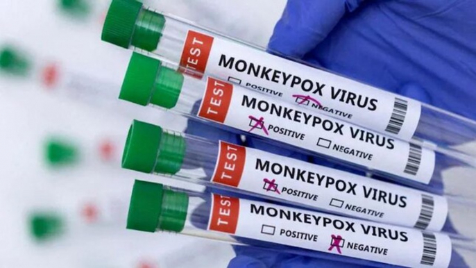 Monkeypox’s symptoms, causes and precautions: Medical experts answer key questions | Watch