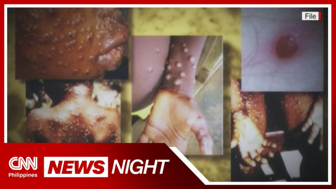 DOH reports two new Monkeypox cases | News Night