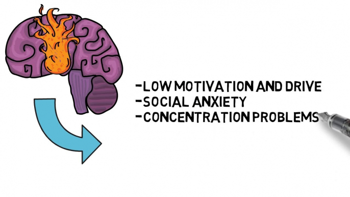 What Porn Can Do To Your Brain And How To Fix it | PART 2 Porn Addiction