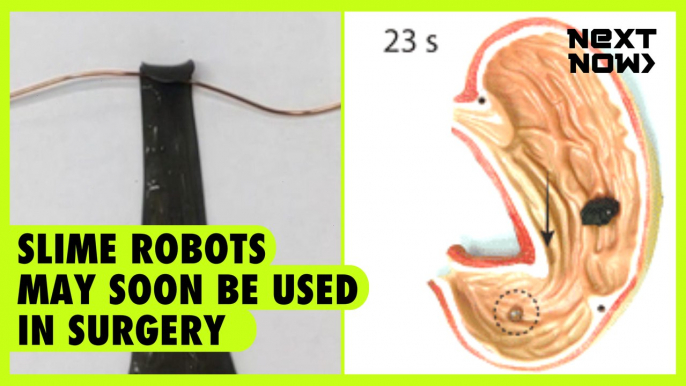 Slime robots may soon be used in surgery | NEXT NOW