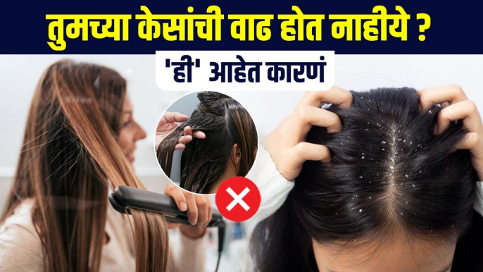 तुमच्या केसांची वाढ न होण्याचं 'हे' आहे कारण | Fast Hair Growth Tips In Marathi |Hair Care Tips MA2