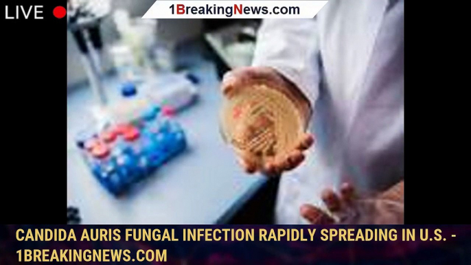 Candida auris fungal infection rapidly spreading in U.S. - 1breakingnews.com